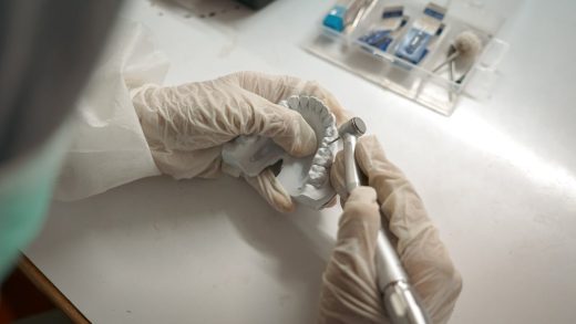 denture repair service in Cape Town dental laboratory handling dentures